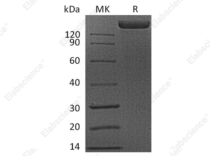 Recombinant Human FLT1 Protein (Fc Tag) - 1