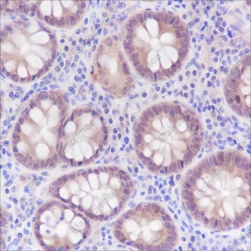 Recombinant SETBP1 Monoclonal Antibody - 2