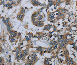 PCK2 Polyclonal Antibody - 3