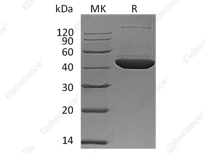 Recombinant Human DHPS Protein (His Tag) - 1