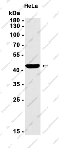 Recombinant ASS1 Monoclonal Antibody - 2