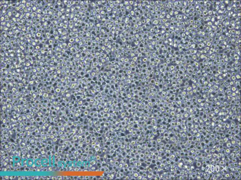 NOMO-1 Cell Complete Medium - 6