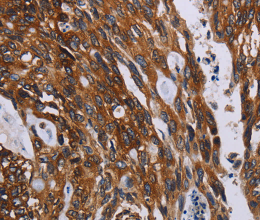 KARS Polyclonal Antibody - 3