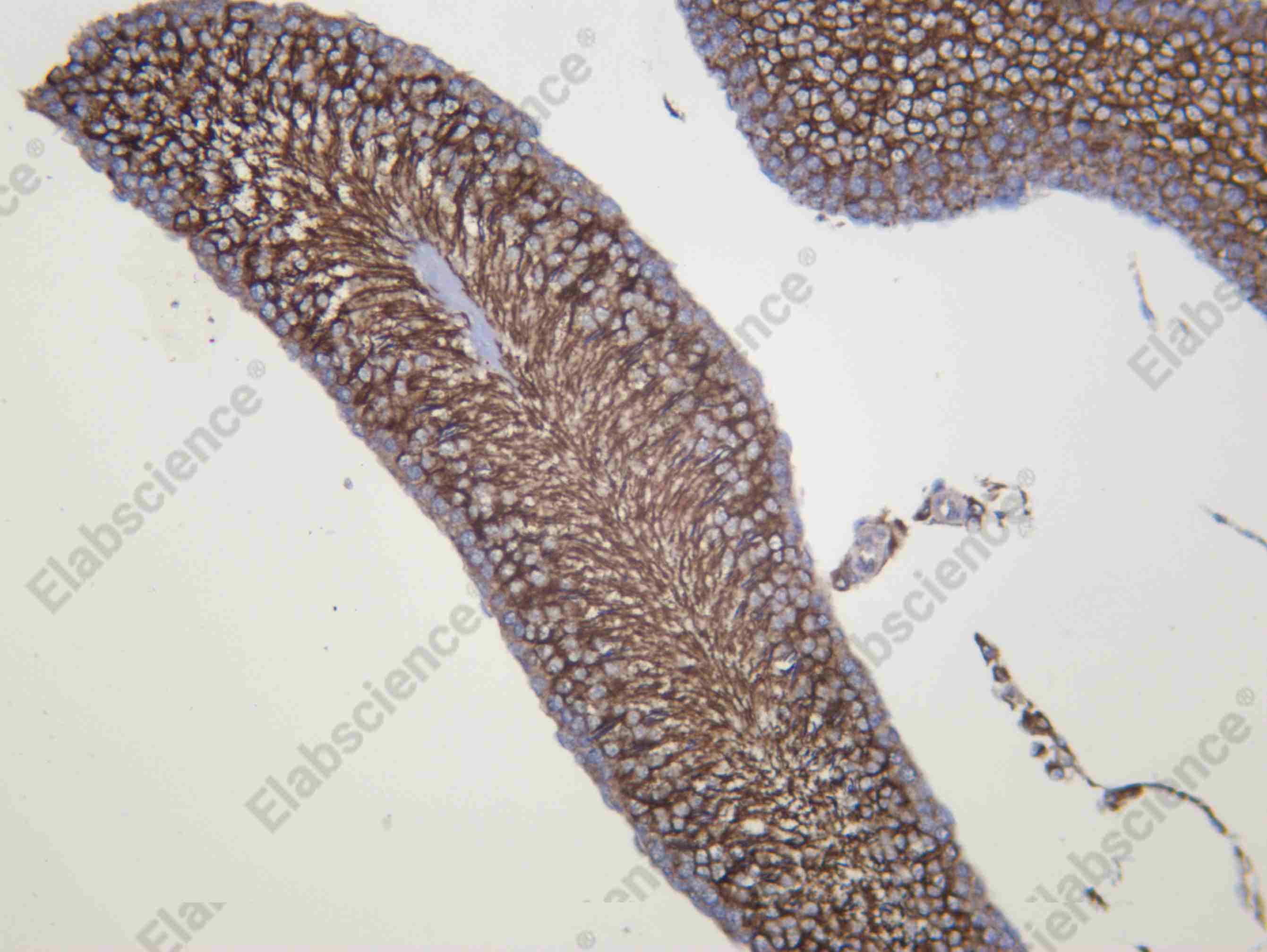 Recombinant CUL 2 Monoclonal Antibody - 3