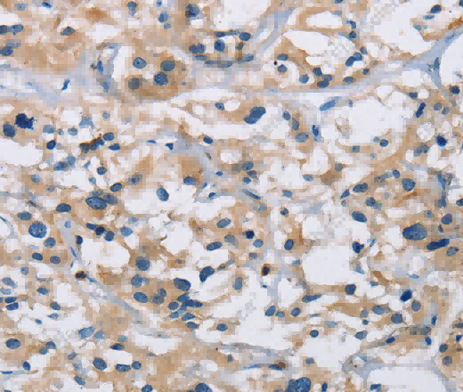 IL17RB Polyclonal Antibody - 3