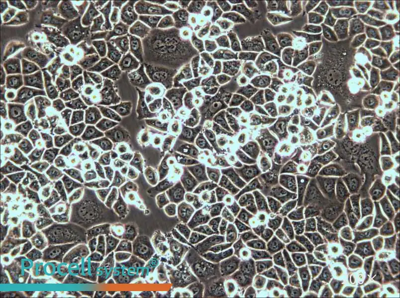 AU565 Cell Complete Medium - small - 6