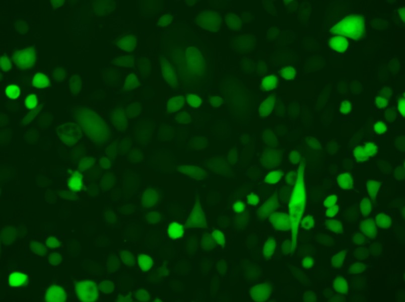 AGS-LUC-EGFP Cell Complete Medium - small - 5