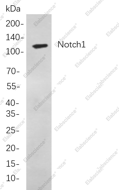 Recombinant Notch1 Monoclonal Antibody - 1