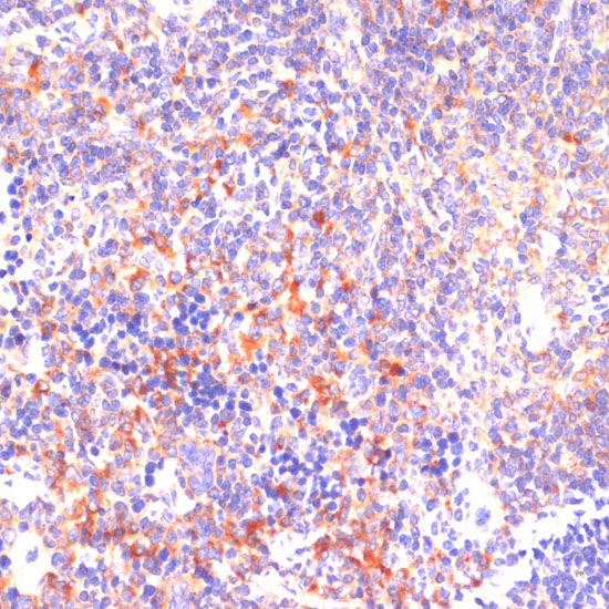 Immunohistochemistry of paraffin-embedded Mouse spleen using ROCK1 Polyclonal Antibody at dilution of 1:100 (40x lens).