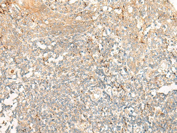 Immunohistochemistry of paraffin-embedded Human tonsil tissue  using GCAT Polyclonal Antibody at dilution of 1:60(?200)