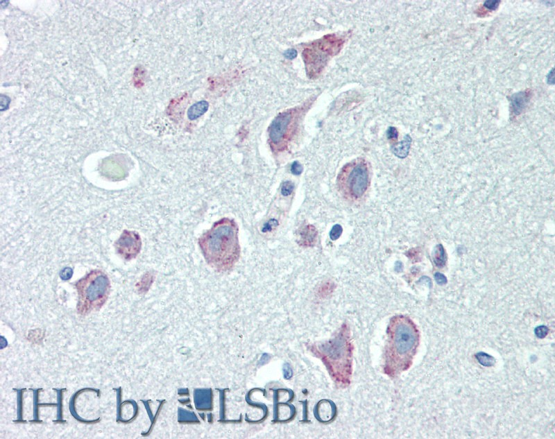 Immunohistochemistry of paraffin-embedded Brain, Cortex tissue using RGS4 Polyclonal Antibody at dilution of 1:100(Elabscience Product Detected by Lifespan).