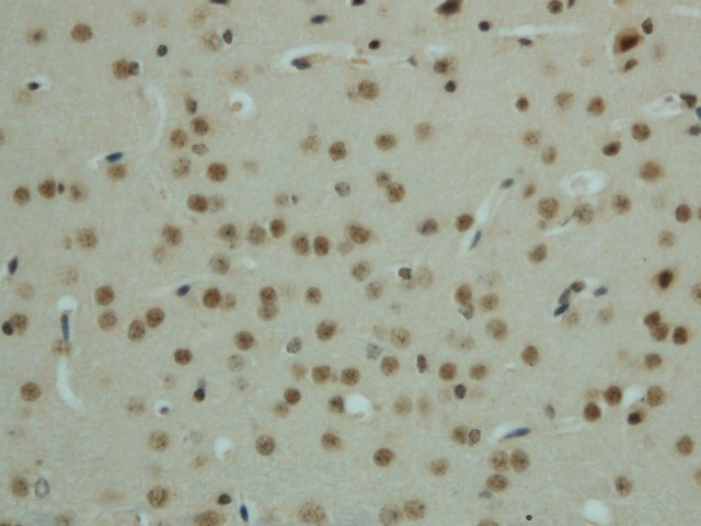 Immunohistochemistry of paraffin-embedded mouse brain  using Phospho-AMPK alpha1/2 (Thr183/172) Polyclonal Antibody at dilution of 1:50