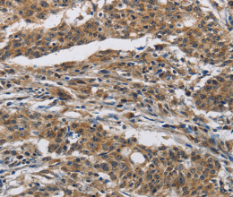 IFNGR2 Polyclonal Antibody - 3