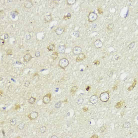 Immunohistochemistry of paraffin-embedded Rat brain using Bcl-2 Polyclonal Antibody at dilution of 1:100 (40x lens).