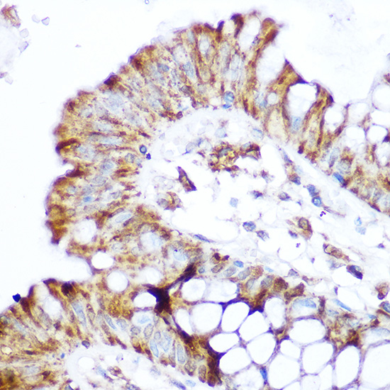 Immunohistochemistry of paraffin-embedded human colon using NOD2 Polyclonal Antibody at dilution of 1:100 (40x lens).Perform microwave antigen retrieval with 10 mM Tris/EDTA buffer pH 9.0 before commencing with IHC staining protocol.