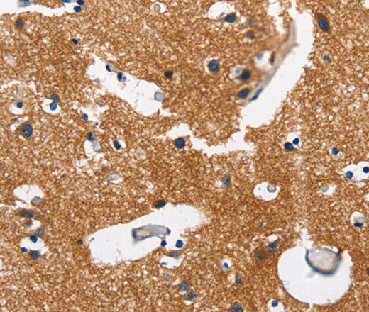 Immunohistochemistry of paraffin-embedded Human brain tissue using CAMK1D Polyclonal Antibody at dilution 1:50