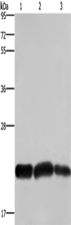 Western Blot analysis of A375 and Raji cell, Human fetal brain tissue using CBX3 Polyclonal Antibody at dilution of 1:600