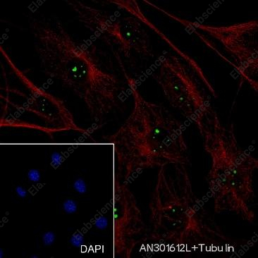 Recombinant NPM1 Monoclonal Antibody - 6