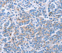 Claudin 4 Polyclonal Antibody - 2