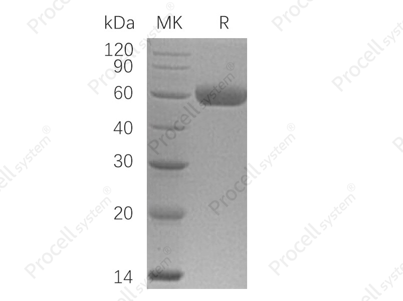 OPG/TNFRSF11B (C-6His), Human, Recombinant