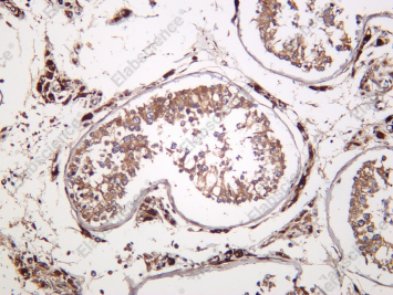 Recombinant VHR Monoclonal Antibody - 1