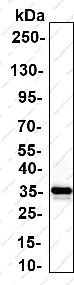 Recombinant PLAUR Monoclonal Antibody - 2