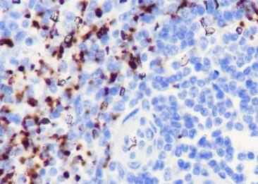 Recombinant CD42b Monoclonal Antibody-searchlist-2