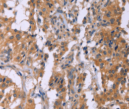 CMTM6 Polyclonal Antibody - 3