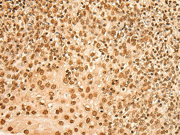 Immunohistochemistry of paraffin-embedded Human tonsil tissue  using HIST1H2BA Polyclonal Antibody at dilution of 1:45(?200)