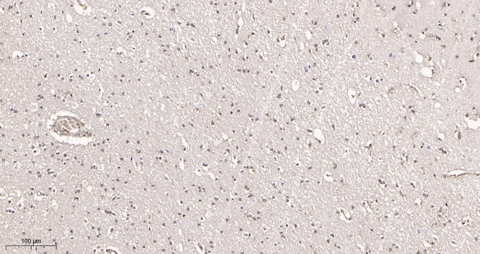 Recombinant Catalase Monoclonal Antibody - small - 2