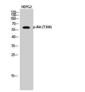 Western Blot analysis of HepG2 cells using Phospho-AKT1 (Thr308) Polyclonal Antibody at dilution of 1:1000