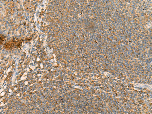 Immunohistochemistry of paraffin-embedded Human tonsil tissue  using CD48 Polyclonal Antibody at dilution of 1:95(?200)