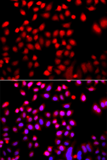 Immunofluorescence analysis of A549 cells using CFL2 Polyclonal Antibody