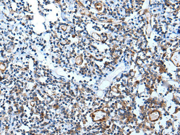 Immunohistochemistry of paraffin-embedded Human tonsil tissue  using USP37 Polyclonal Antibody at dilution of 1:45(?200)