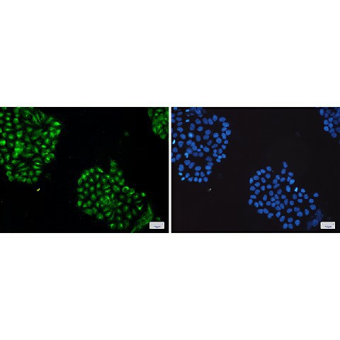 Immunofluorescence of JNK1/2/3 (green) in Hela cells using JNK1/2/3 Rabbit mAb at dilution 1:100, and DAPI(blue)