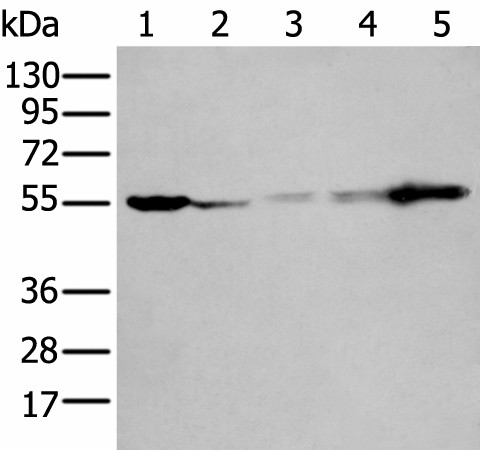 Western blot analysis of 293T A549 A431 Hela and Jurkat cell lysates  using PFKFB3 Polyclonal Antibody at dilution of 1:400