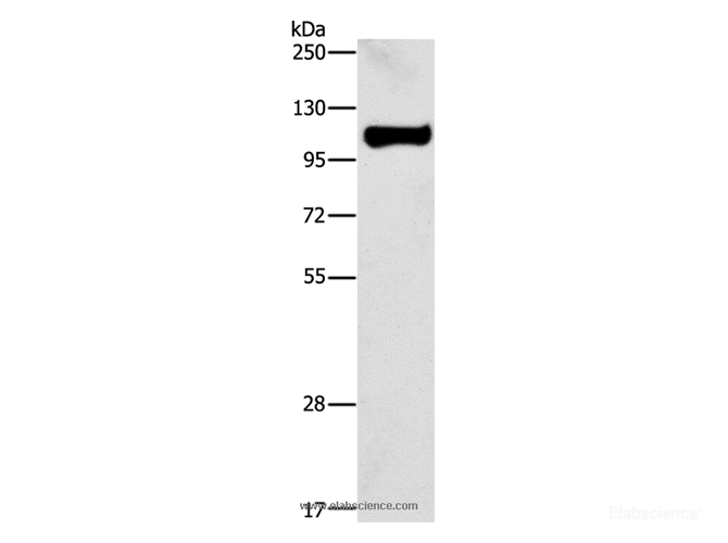 Western Blot analysis of Raji cell using STAT6 Polyclonal Antibody at dilution of 1:450