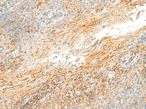 Immunohistochemistry of paraffin-embedded Human tonsil tissue  using MRPS18B Polyclonal Antibody at dilution of 1:55(?200)