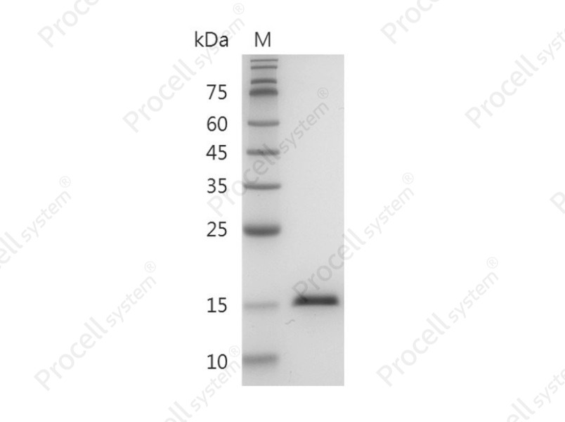 TNF-&alpha;/TNFA/TNFSF2, Human, Recombinant