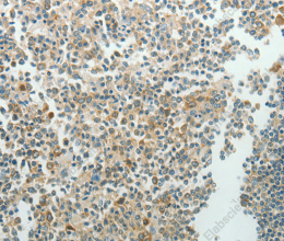 NDRG3 Polyclonal Antibody - 2