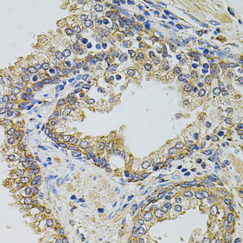 Immunohistochemistry of paraffin-embedded Human prostate using Gm13125 Polyclonal Antibody at dilution of 1:100 (40x lens).