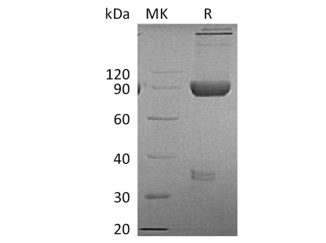 Recombinant Cynomolgus LAG-3/CD223 Protein (Fc Tag)