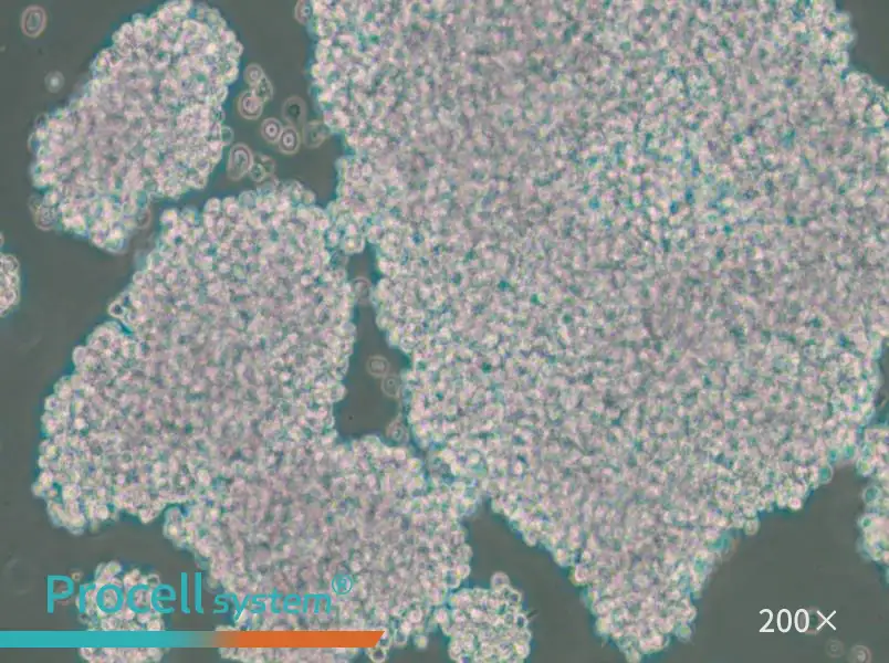 NCI-H1417 Cell Complete Medium - 6