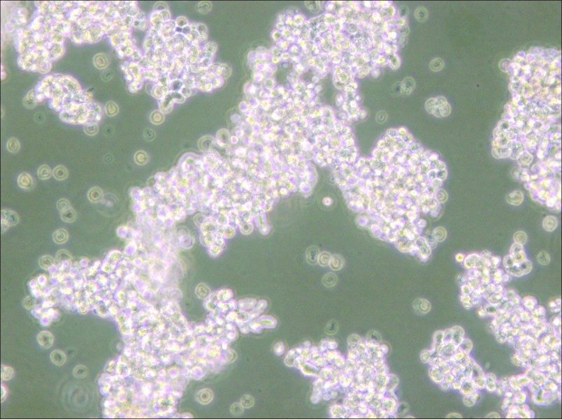 NCI-H69 Cell Complete Medium - small - 5