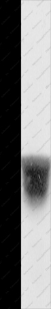 KCNA1 Polyclonal Antibody - 1