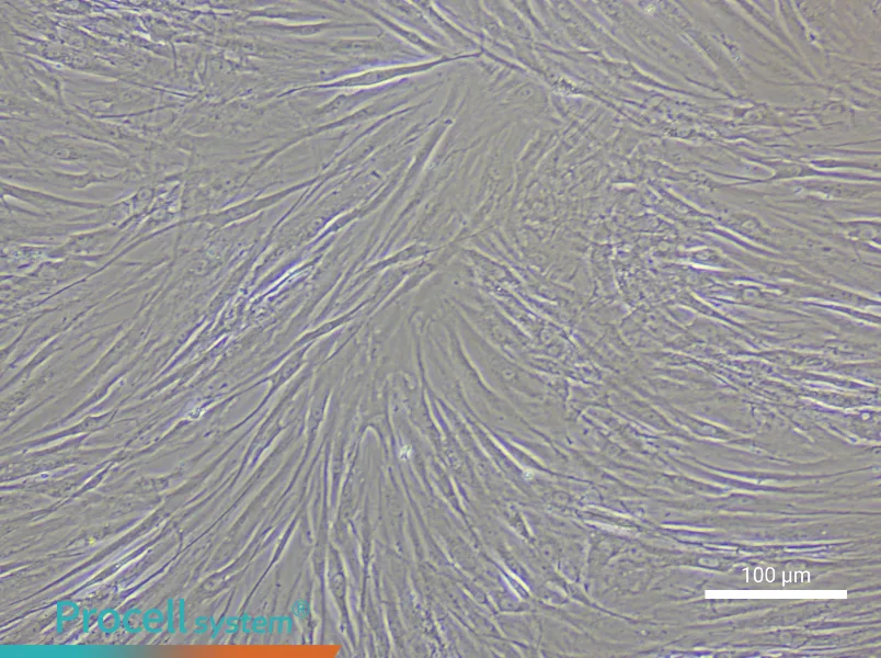 Human Glomerular Mesangial Cell Complete Medium - 3