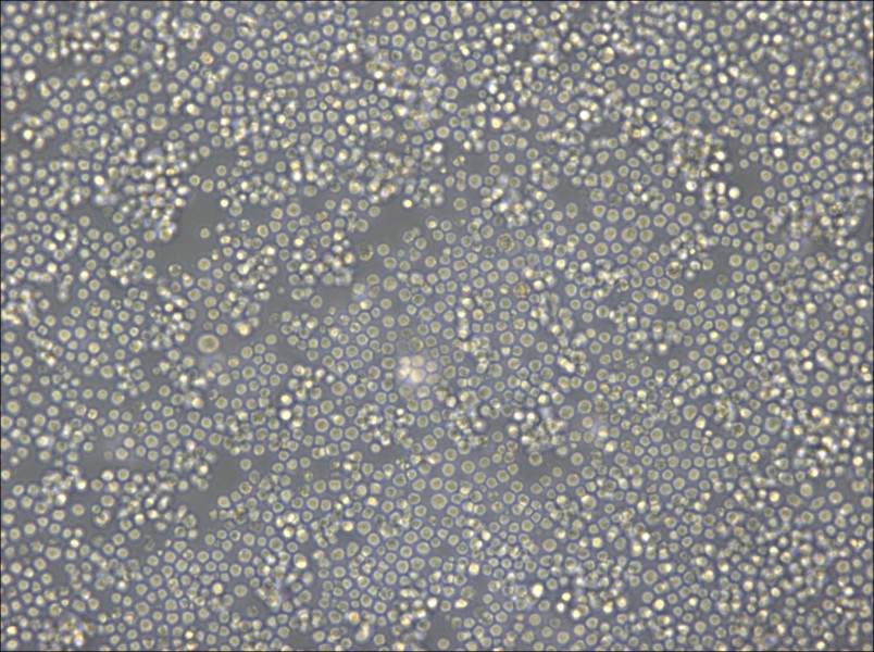 DoHH2 Cell Complete Medium - 4