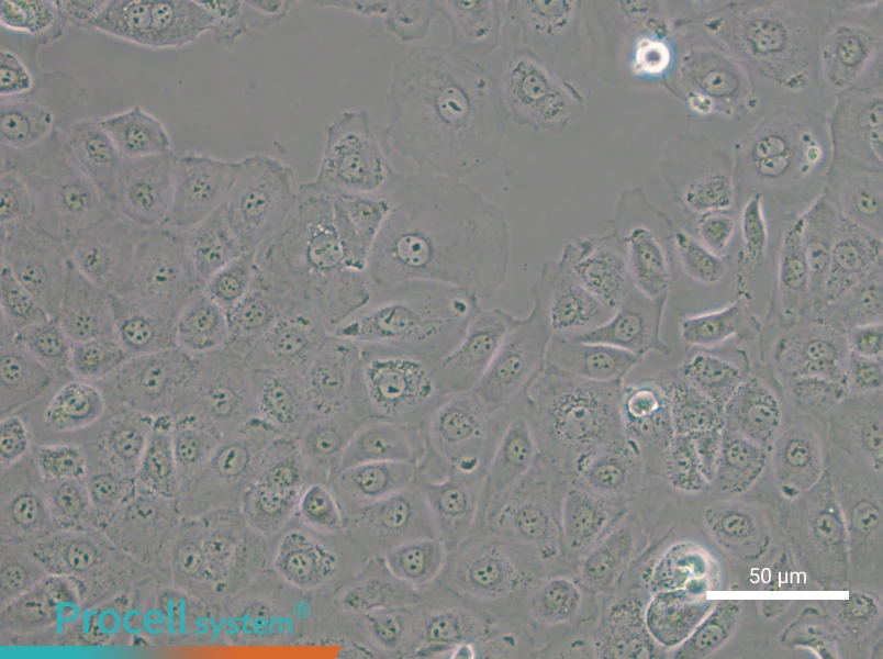 NIH:OVCAR-3 [OVCAR3] - 5