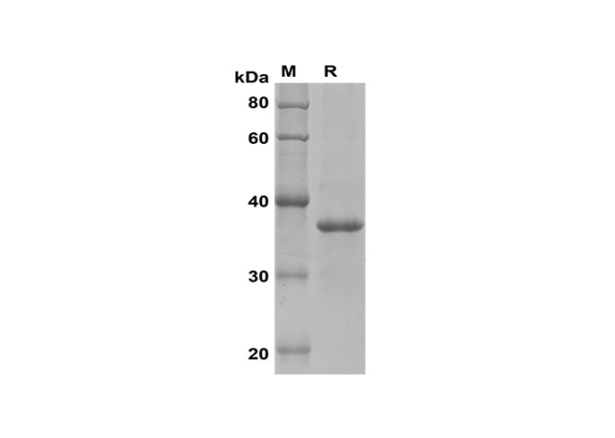 Recombinant chiken IL2/IL-2/Interleukin-2 Protein(His Tag)-产品推荐-1