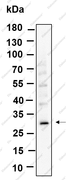 Recombinant ZWINT Monoclonal Antibody - 1